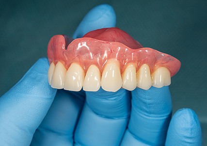 Blue gloved hand holding an upper arch of dentures