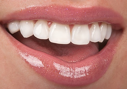 An up-close image of a person’s smile that has undergone teeth whitening